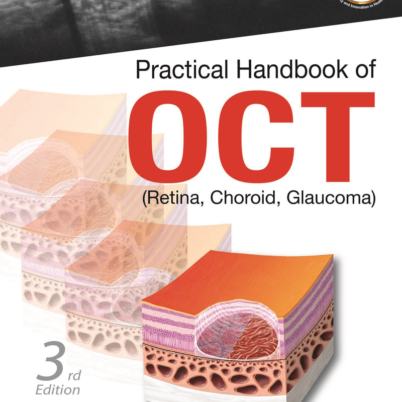 PRACTICAL HANDBOOK OF OCT (RETINA, CHOROID, GLAUCOMA),3/E,MARCO RISPOLI