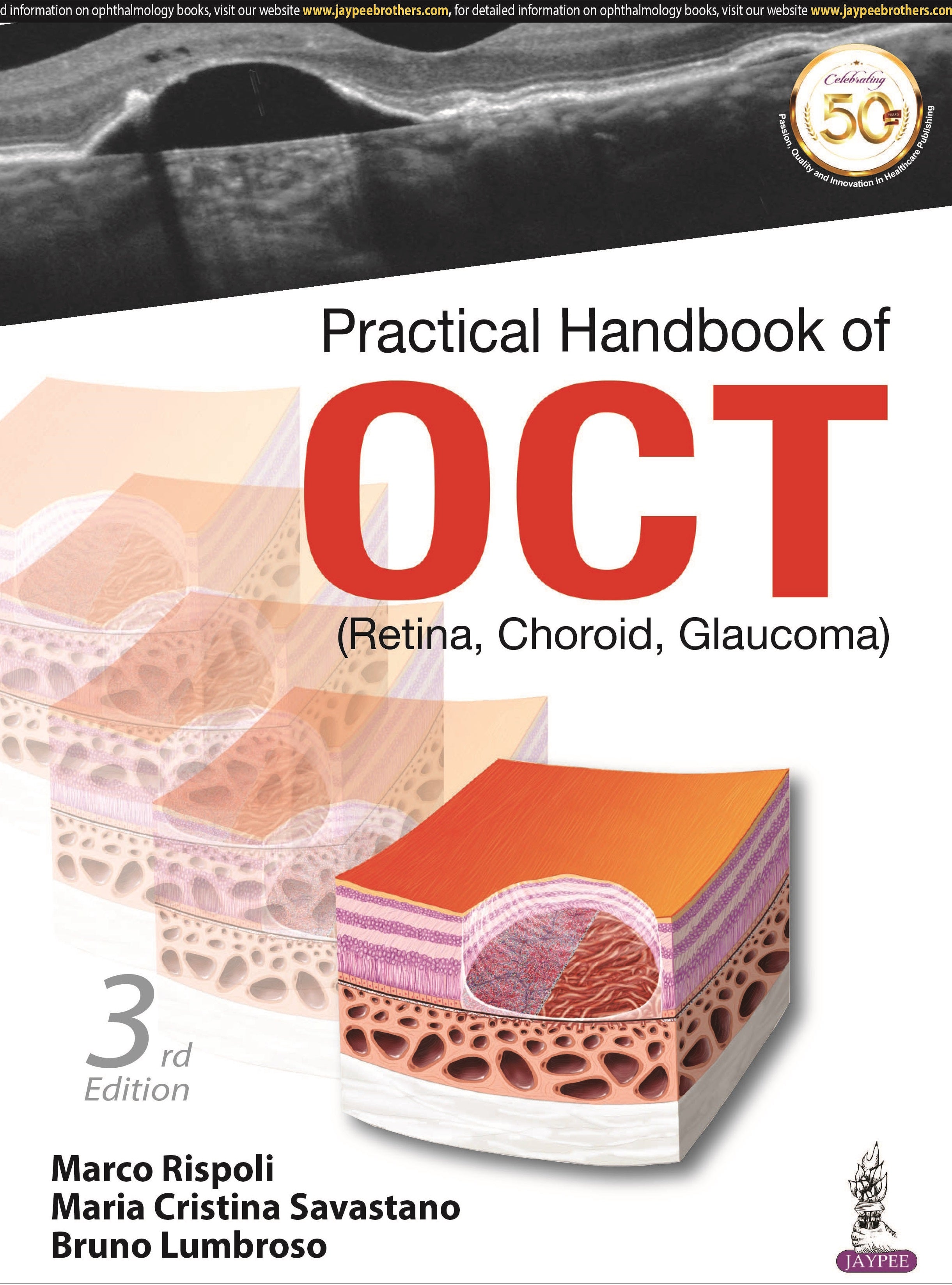 PRACTICAL HANDBOOK OF OCT (RETINA, CHOROID, GLAUCOMA),3/E,MARCO RISPOLI