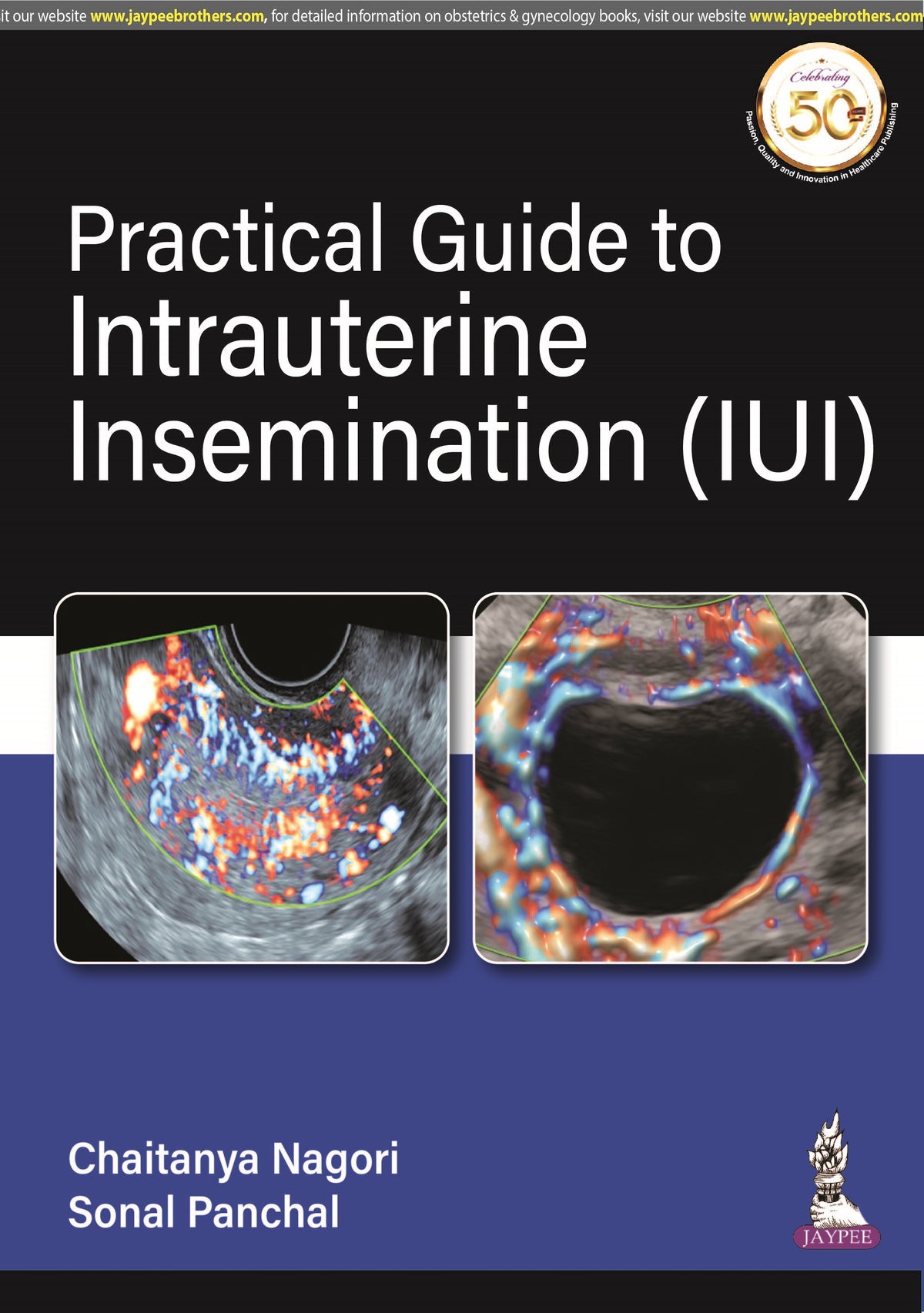 PRACTICAL GUIDE TO INTRAUTERINE INSEMINATION (IUI),1/E,CHAITANYA NAGORI