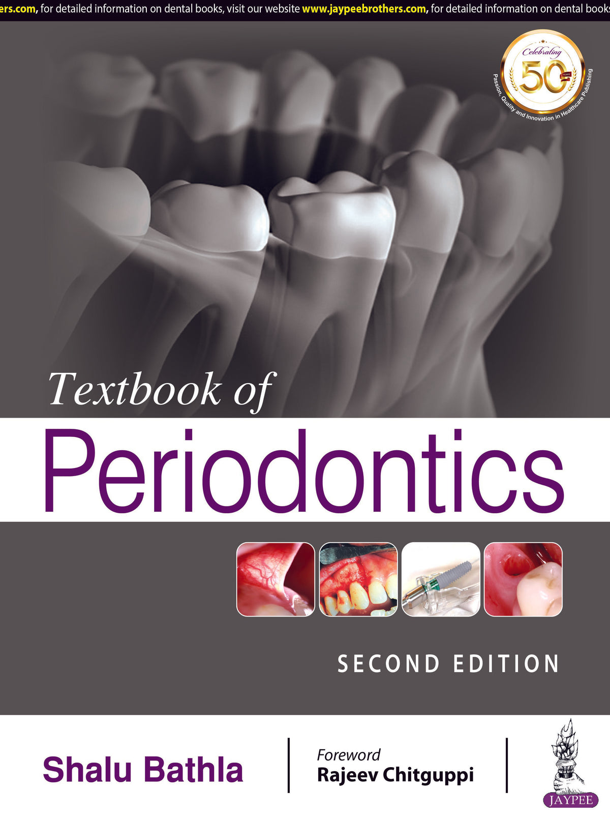 TEXTBOOK OF PERIODONTICS,2/E,SHALU BATHLA