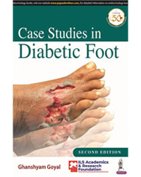 CASE STUDIES IN DIABETIC FOOT,2/E,GHANSHYAM GOYAL