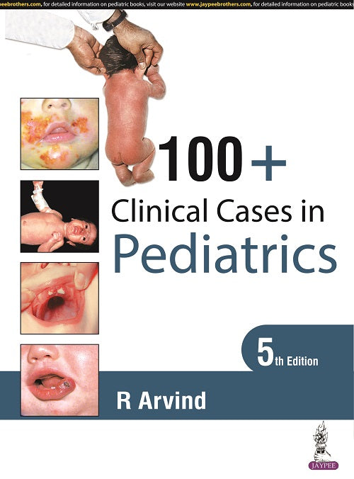 100+ CLINICAL CASES IN PEDIATRICS,5/E,R ARVIND
