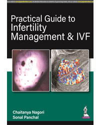 PRACTICAL GUIDE TO INFERTILITY MANAGEMENT & IVF 1/E by CHAITANYA NAGORI