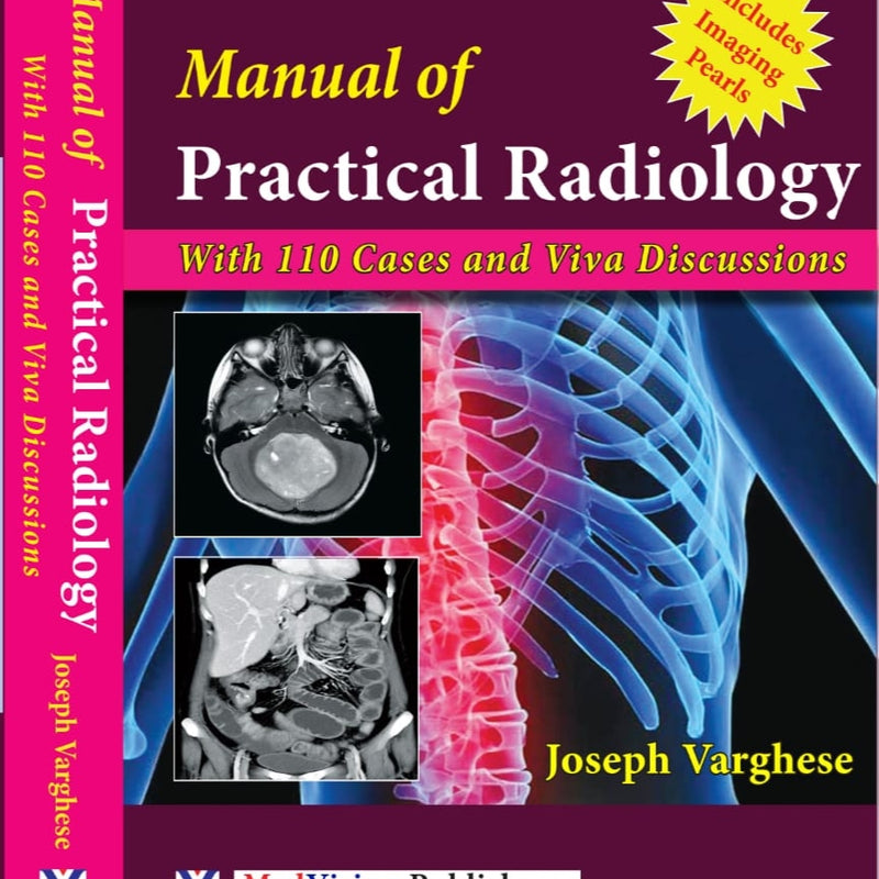 Manual of Practical Radiology with 110 cases and viva discussion