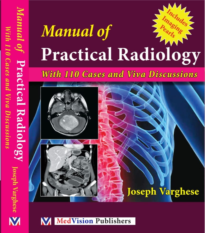 Manual of Practical Radiology with 110 cases and viva discussion