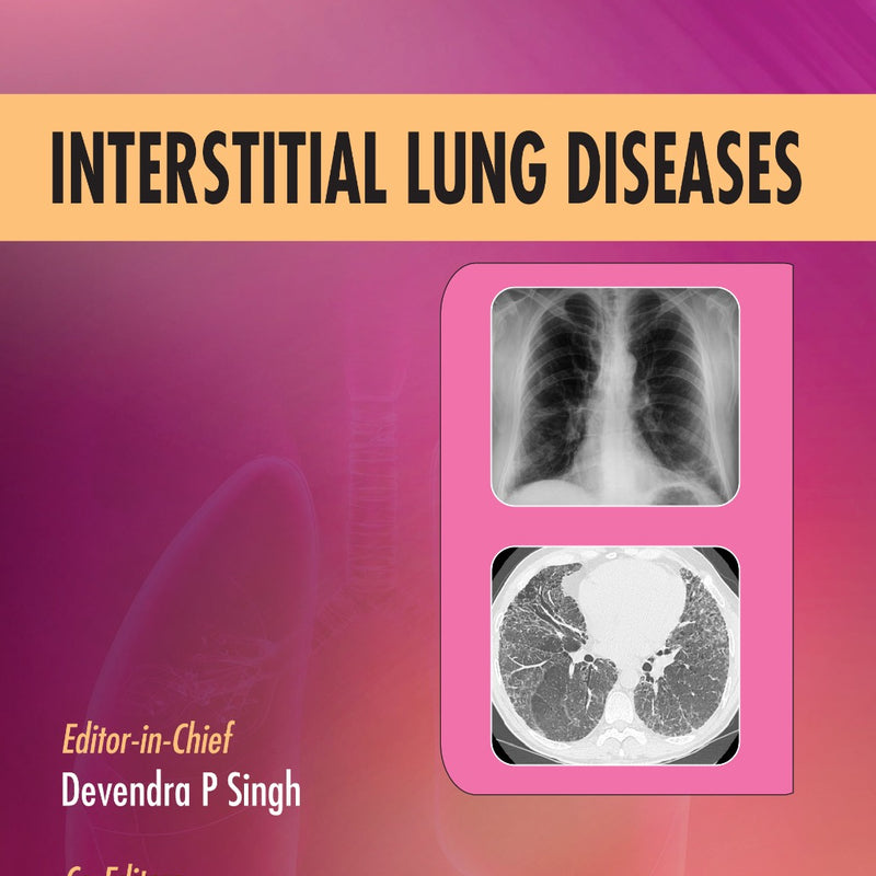 Interstitial Lung Disease 1st/2023 by 
Devendra P Singh, Agam C Vora, Deependra Kumar Rai
