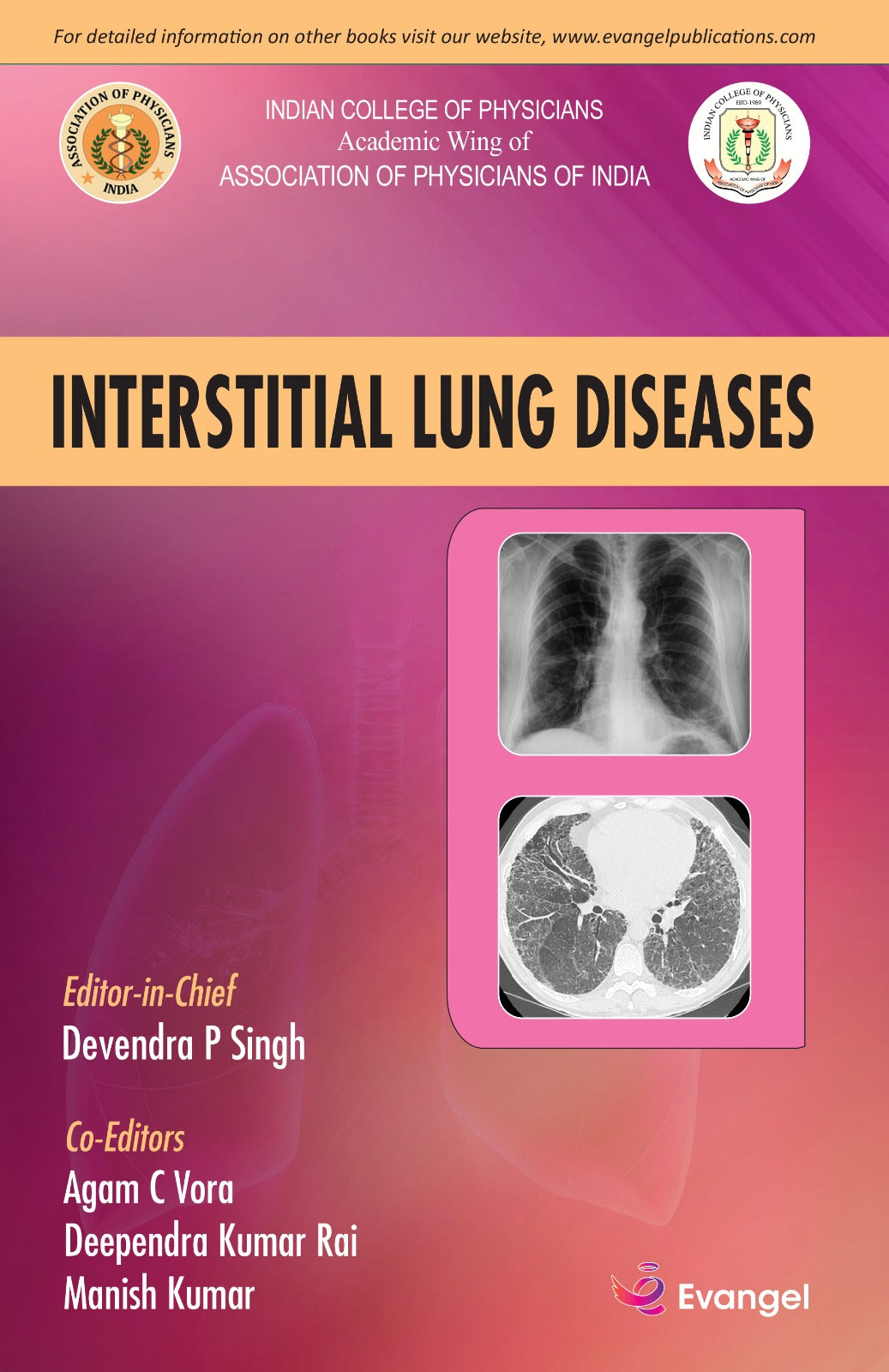 Interstitial Lung Disease 1st/2023 by 
Devendra P Singh, Agam C Vora, Deependra Kumar Rai