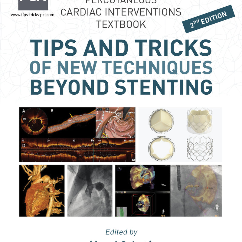 Tips and Tricks of New Techniques Beyond Stenting 2nd/2023
By Manel Sabate