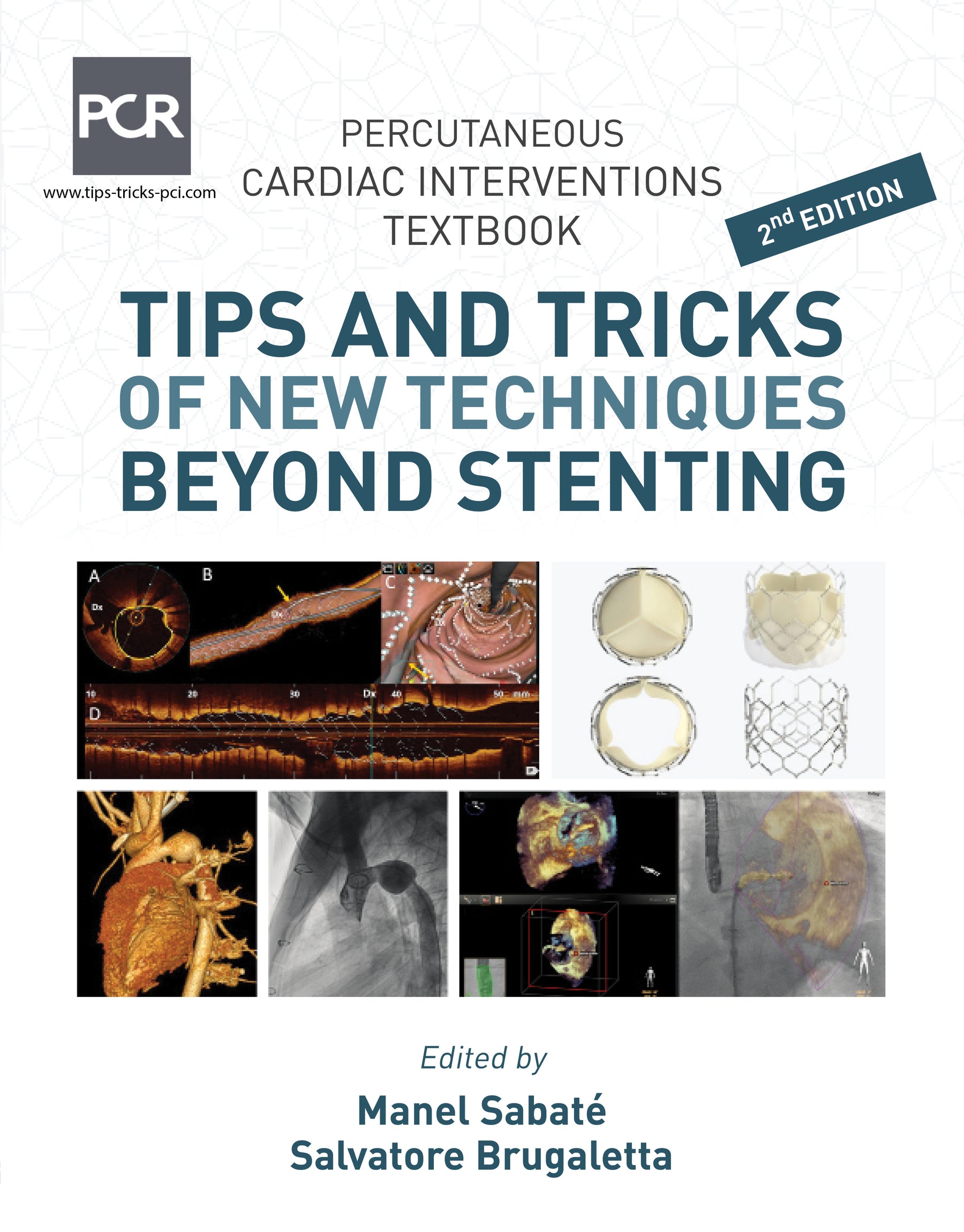 Tips and Tricks of New Techniques Beyond Stenting 2nd/2023
By Manel Sabate